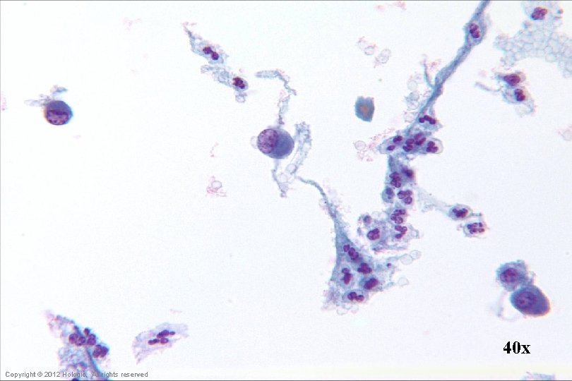 40 x Hologic Proprietary © 2012 Copyright © 2012 Hologic, All rights reserved 