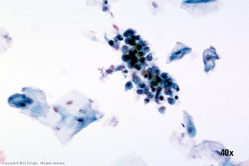 Hologic Proprietary © 2012 Copyright © 2012 Hologic, All rights reserved 