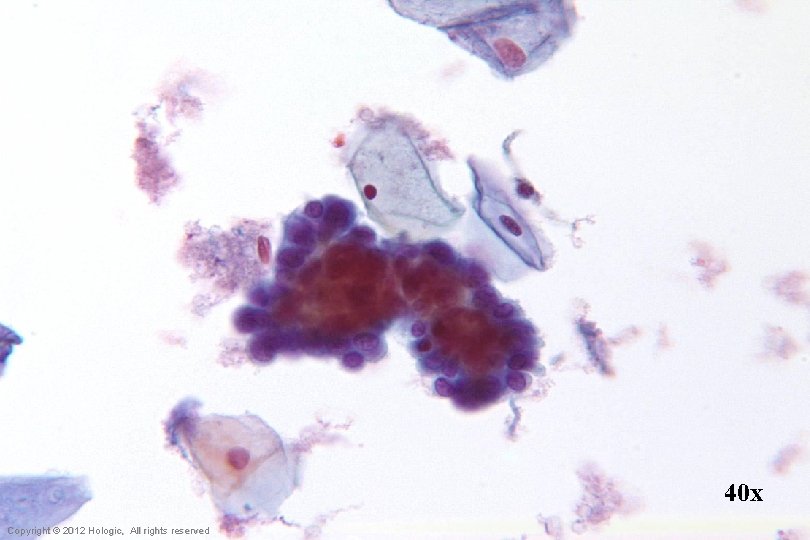 40 x Hologic Proprietary © 2012 Copyright © 2012 Hologic, All rights reserved 