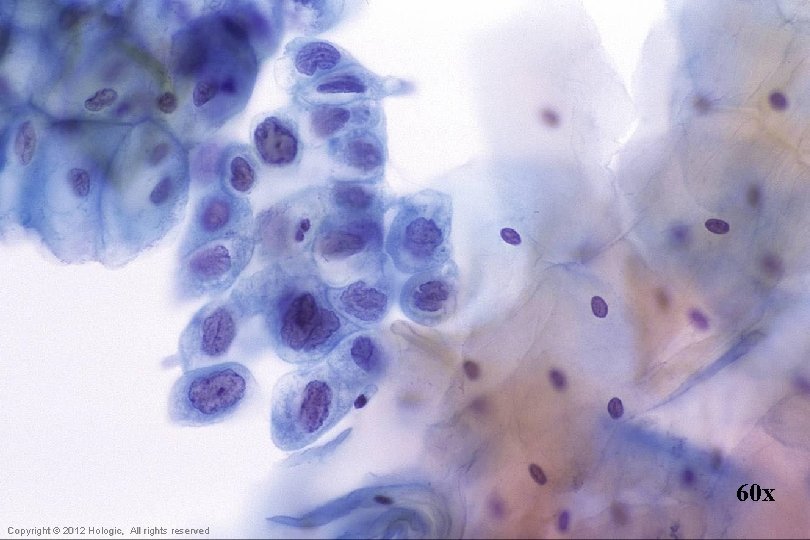 60 x Hologic Proprietary © 2012 Copyright © 2012 Hologic, All rights reserved 