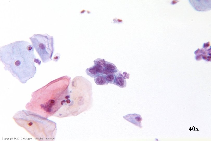 40 x Hologic Proprietary © 2012 Copyright © 2012 Hologic, All rights reserved 