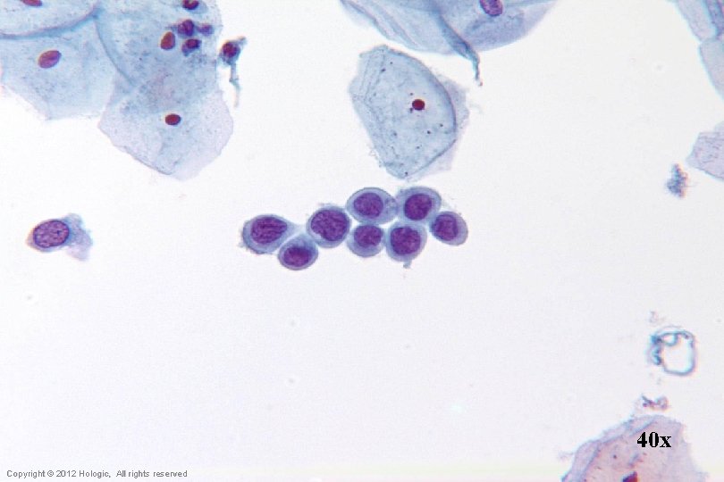 40 x Hologic Proprietary © 2012 Copyright © 2012 Hologic, All rights reserved 