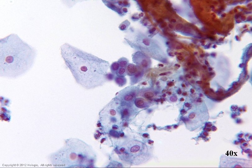 40 x Hologic Proprietary © 2012 Copyright © 2012 Hologic, All rights reserved 