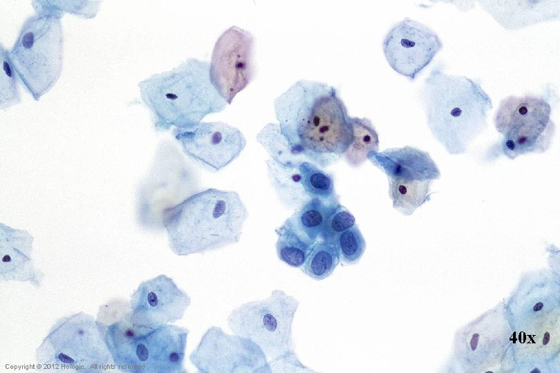 40 x Hologic Proprietary © 2012 Copyright © 2012 Hologic, All rights reserved 