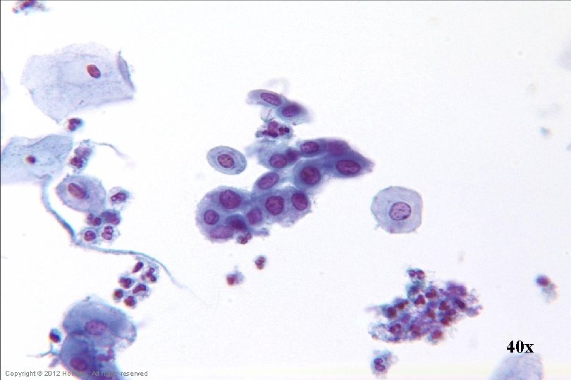 40 x Hologic Proprietary © 2012 Copyright © 2012 Hologic, All rights reserved 