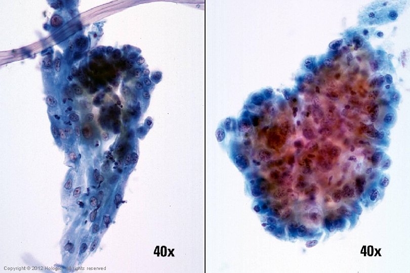 Hologic Proprietary © 2012 Copyright © 2012 Hologic, All rights reserved 