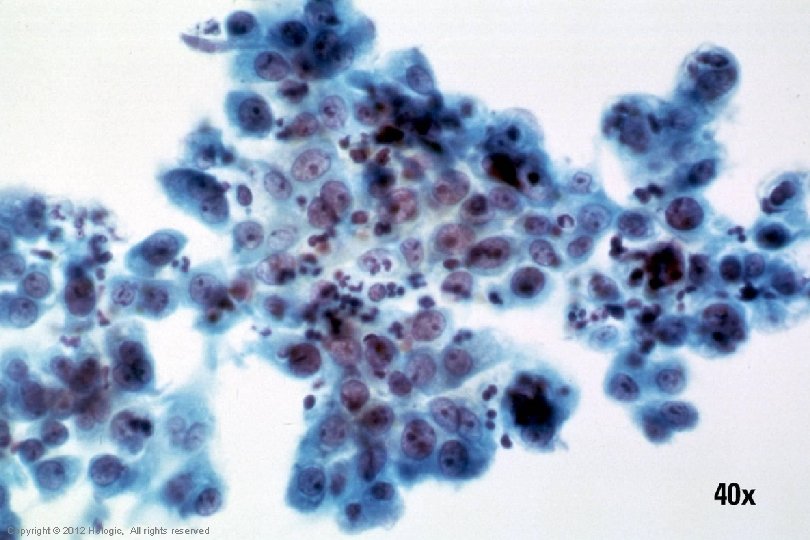 Hologic Proprietary © 2012 Copyright © 2012 Hologic, All rights reserved 