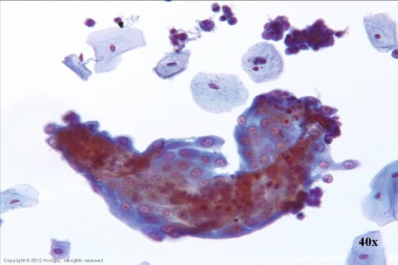 40 x Hologic Proprietary © 2012 Copyright © 2012 Hologic, All rights reserved 