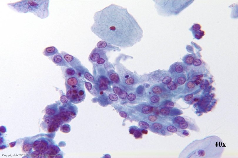 40 x Hologic Proprietary © 2012 Copyright © 2012 Hologic, All rights reserved 