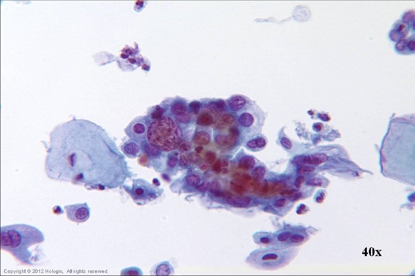 40 x Hologic Proprietary © 2012 Copyright © 2012 Hologic, All rights reserved 