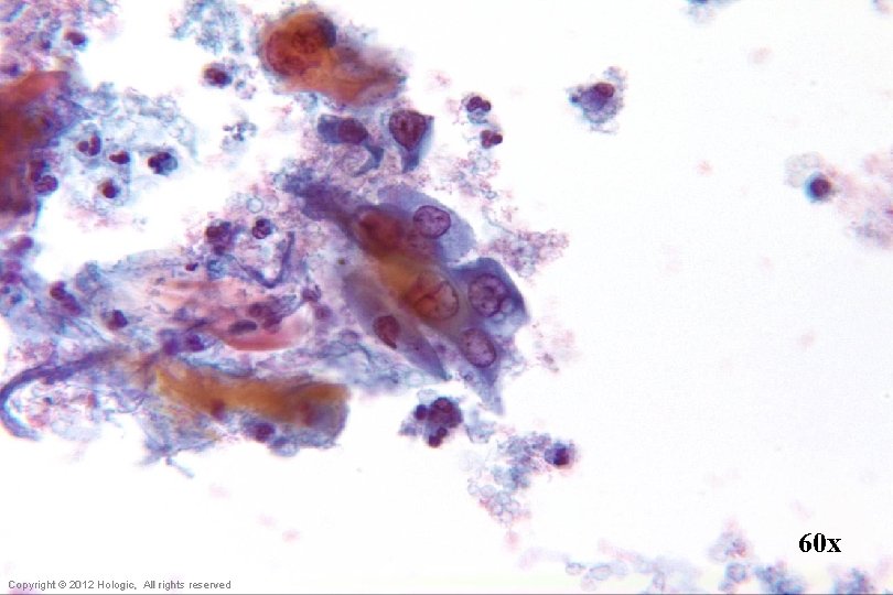 60 x Hologic Proprietary © 2012 Copyright © 2012 Hologic, All rights reserved 