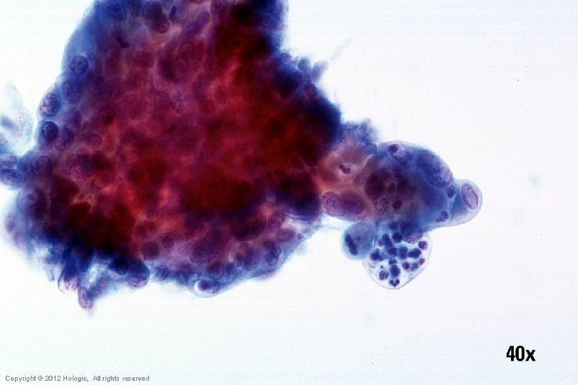 Hologic Proprietary © 2012 Copyright © 2012 Hologic, All rights reserved 