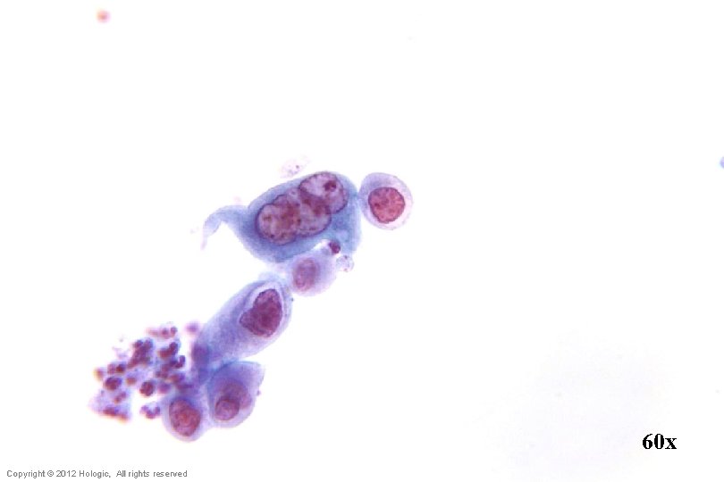 60 x Hologic Proprietary © 2012 Copyright © 2012 Hologic, All rights reserved 