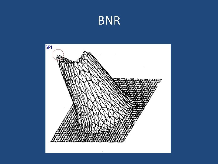 BNR SPI 