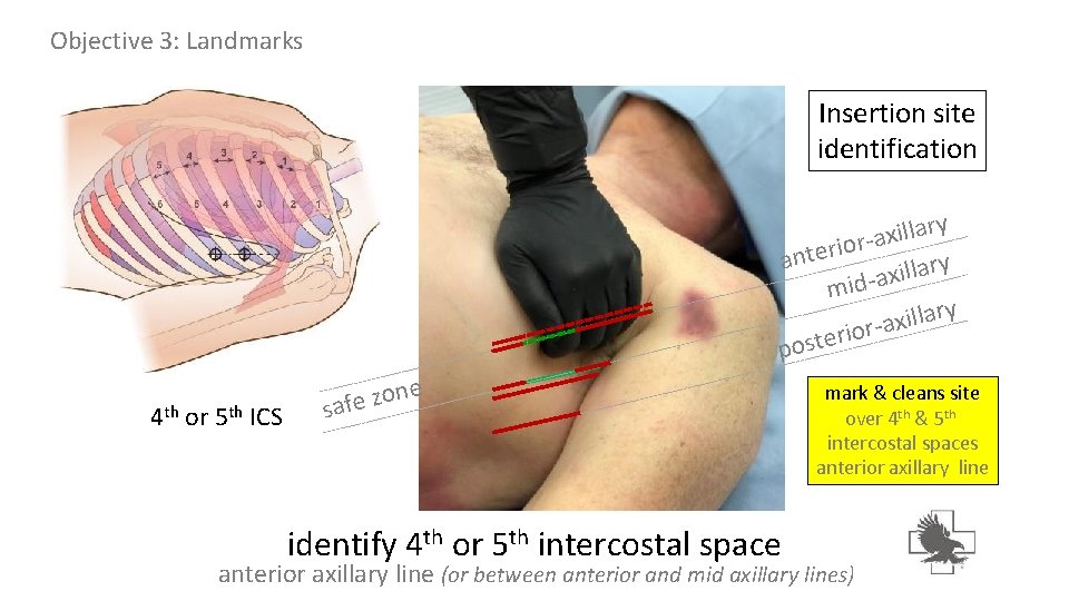 Objective 3: Landmarks Insertion site identification ary l l i x a or i Objective 3: Landmarks Insertion site identification ary l l i x a or i