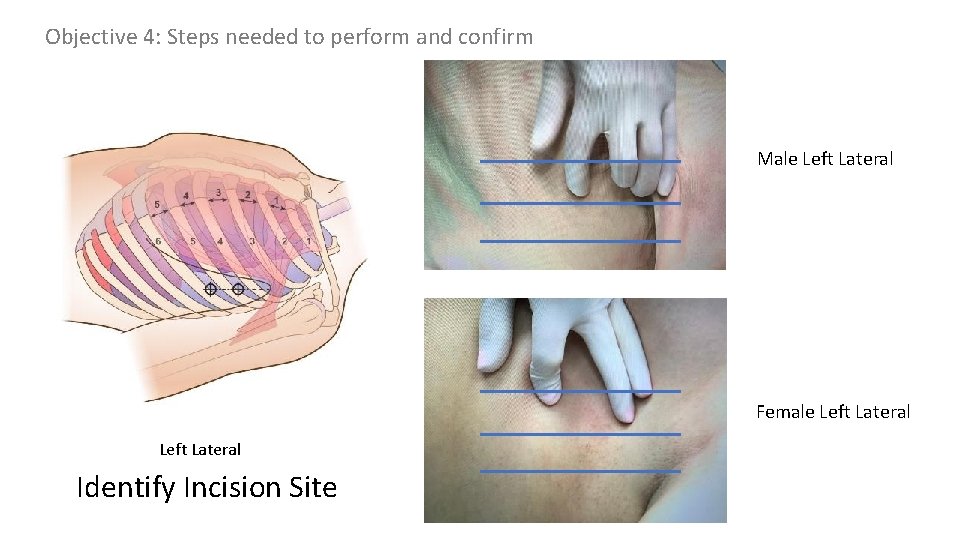 Objective 4: Steps needed to perform and confirm Male Left Lateral Female Left Lateral Objective 4: Steps needed to perform and confirm Male Left Lateral Female Left Lateral
