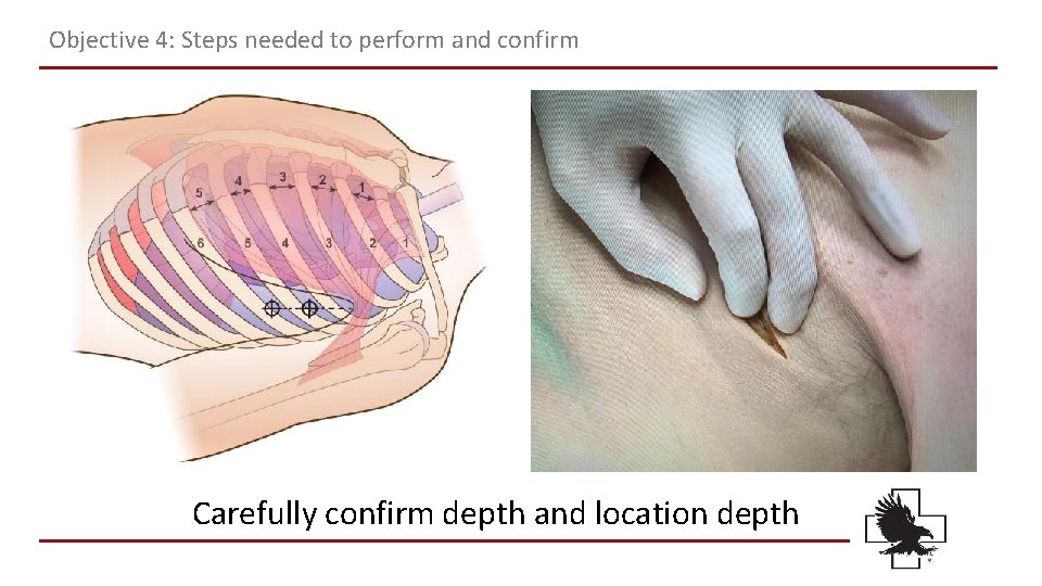 Objective 4: Steps needed to perform and confirm Carefully confirm depth and location depth Objective 4: Steps needed to perform and confirm Carefully confirm depth and location depth