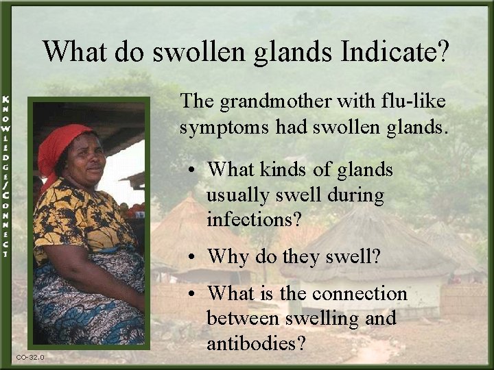 What do swollen glands Indicate? The grandmother with flu-like symptoms had swollen glands. •