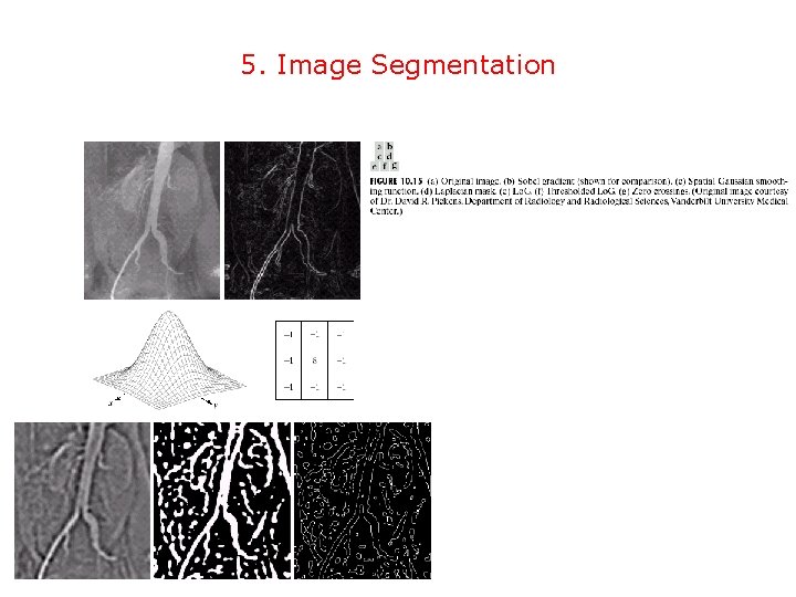 5. Image Segmentation 