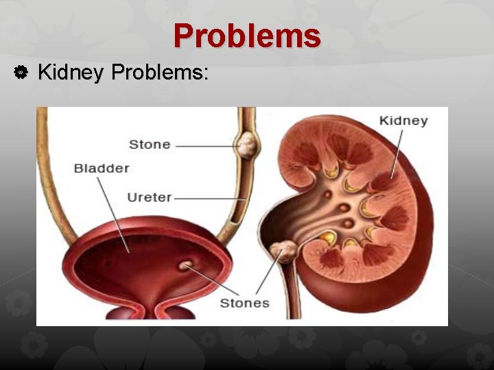 Problems Kidney Problems: 