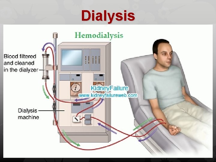 Dialysis 