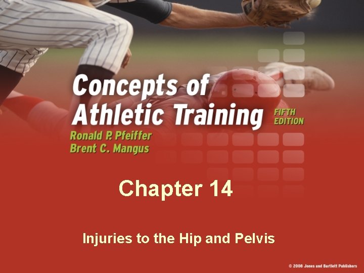 Chapter 14 Injuries to the Hip and Pelvis