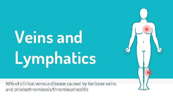 Veins and Lymphatics 90% of clinical venous disease caused by Varicose veins and phlebothrombosis/thrombophlebitis