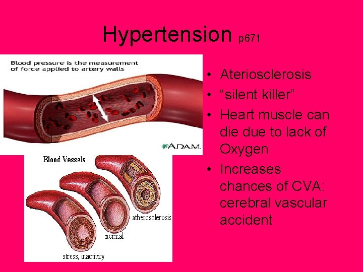 Hypertension p 671 • Ateriosclerosis • “silent killer” • Heart muscle can die due