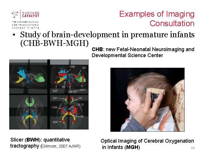Examples of Imaging Consultation • Study of brain-development in premature infants (CHB-BWH-MGH) CHB: new