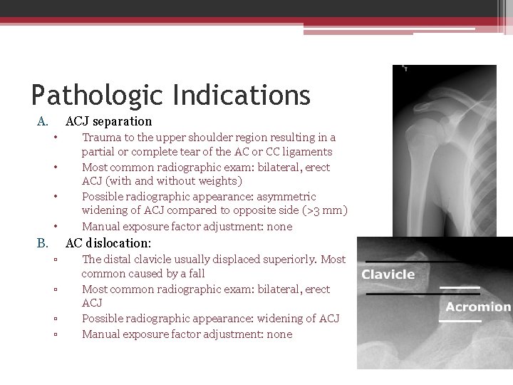 Pathologic Indications A. ACJ separation • • B. Trauma to the upper shoulder region