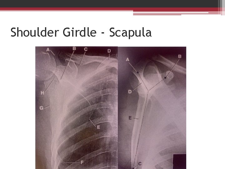 Shoulder Girdle - Scapula 