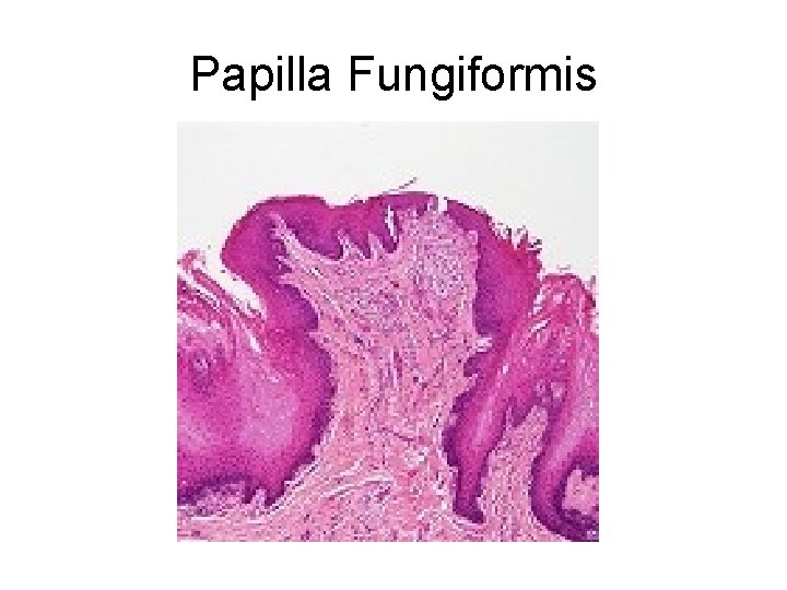 Papilla Fungiformis 