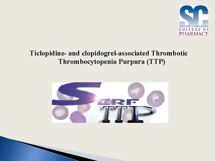Ticlopidine- and clopidogrel-associated Thrombotic Thrombocytopenia Purpura (TTP) 