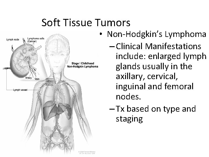Soft Tissue Tumors • Non-Hodgkin’s Lymphoma – Clinical Manifestations include: enlarged lymph glands usually