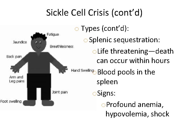 Sickle Cell Crisis (cont’d) o Types (cont’d): o Splenic sequestration: o. Life threatening—death can