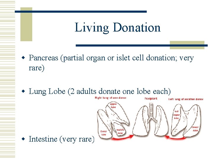Living Donation w Pancreas (partial organ or islet cell donation; very rare) w Lung