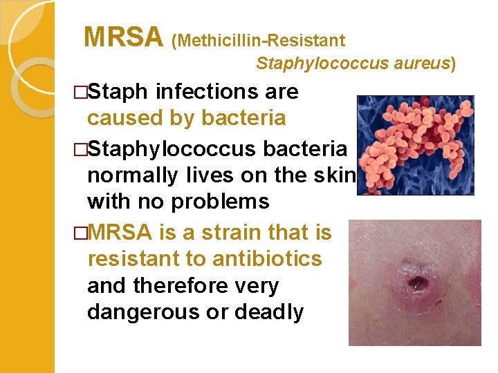 MRSA (Methicillin-Resistant Staphylococcus aureus) �Staph infections are caused by bacteria �Staphylococcus bacteria normally lives