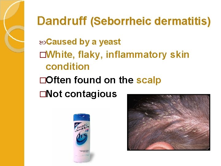 Dandruff (Seborrheic dermatitis) Caused �White, by a yeast flaky, inflammatory skin condition �Often found