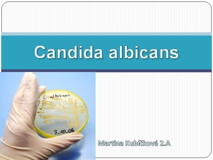 Candida albicans Martina Kubíčková 2. A 