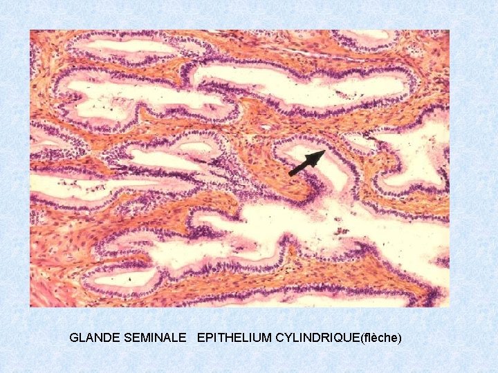 GLANDE SEMINALE EPITHELIUM CYLINDRIQUE(flèche) 