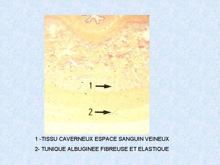 1 -TISSU CAVERNEUX ESPACE SANGUIN VEINEUX 2 - TUNIQUE ALBUGINEE FIBREUSE ET ELASTIQUE 