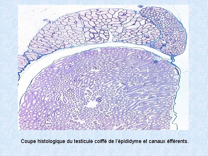 Coupe histologique du testicule coiffé de l’épididyme et canaux éfférents. 
