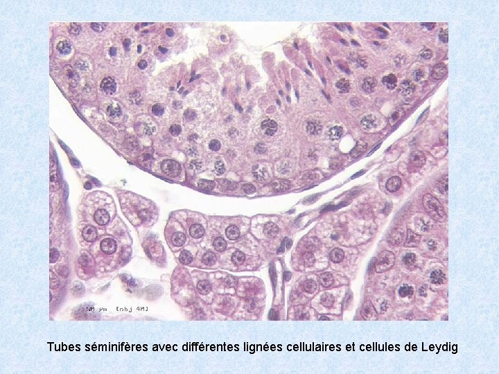 Tubes séminifères avec différentes lignées cellulaires et cellules de Leydig 