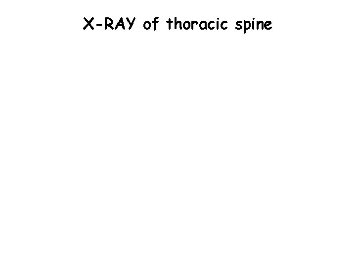 X-RAY of thoracic spine 