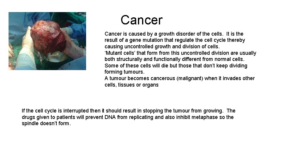 Cancer is caused by a growth disorder of the cells. It is the result