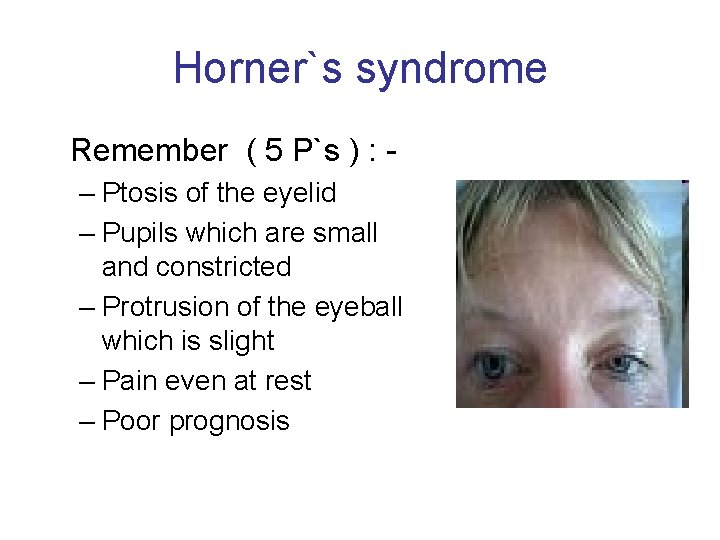 Horner`s syndrome Remember ( 5 P`s ) : – Ptosis of the eyelid –