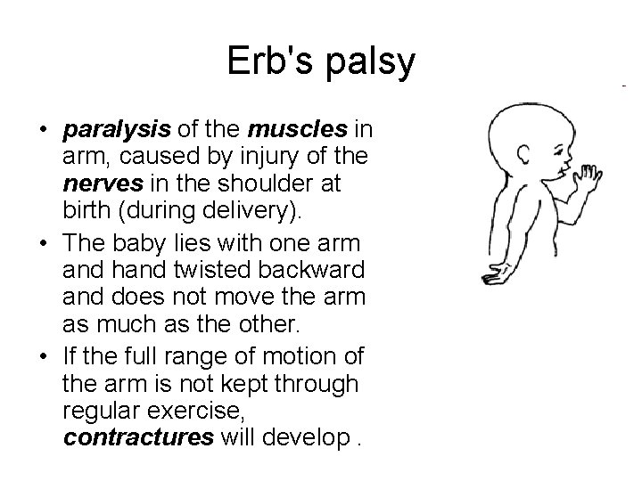 Erb's palsy • paralysis of the muscles in arm, caused by injury of the