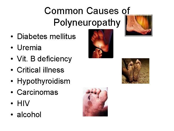 Common Causes of Polyneuropathy • • Diabetes mellitus Uremia Vit. B deficiency Critical illness