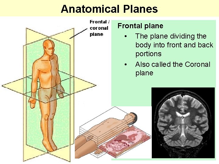Anatomical Planes Frontal plane • The plane dividing the body into front and back