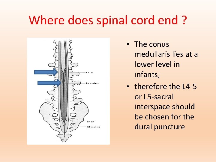 Where does spinal cord end ? • The conus medullaris lies at a lower